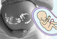 प्रेगनेंसी में एमनिओटिक फ्लूइड का कम और ज्यादा होना – Amniotic Fluid प्रेगनेंसी में एमनिओटिक फ्लूइड का कम और ज्यादा होना – Amniotic fluid