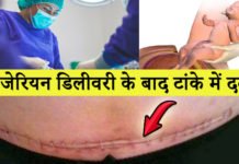 सिजेरियन डिलीवरी के बाद टांके में दर्द – 10 Ways to Manage Pain After C-Section सिजेरियन डिलीवरी के बाद टांके में दर्द