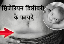 सिजेरियन डिलीवरी के फायदे और नुक्सान – C-Section benefits सिजेरियन डिलीवरी के फायदे - C- Section benefits